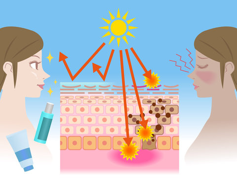 UV care before after image, young girl puts on the sunscreen or not, mechanism of the sunburn, vector illustration