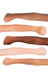 Skin color