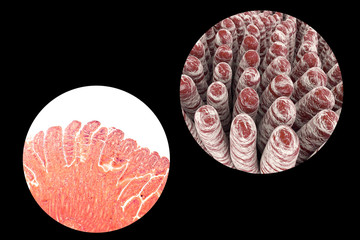 Villi of small intestine, light micrograph and 3D illustration.