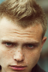 Obraz premium Handsome young man with sunspots on face looking at camera.