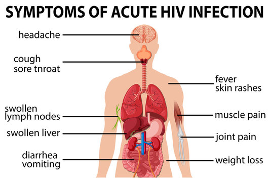 Chart of symtoms of acute HIV infection