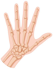 Obraz premium Fracture in human hand