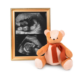 Frame with ultrasound scan of baby and bear toy isolated on white