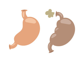 Bloating digestive problems medicine pain health. Anatomy gastric organ digestive problems system biology abdomen illness. People sick healthcare digestive problems sickness indigestion vector.