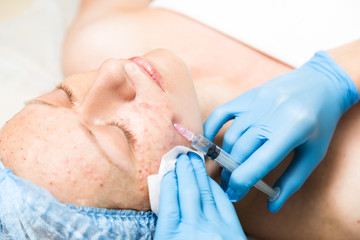 Beautician makes biorevitalization to young woman. The cosmetic procedures for the face. Beauty...