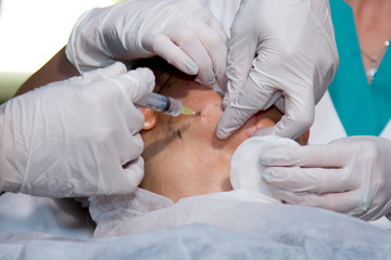 cosmetology, injection, plastic surgery face