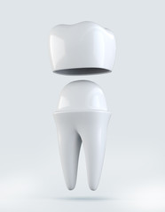3D illustration of Crown tooth on white background.