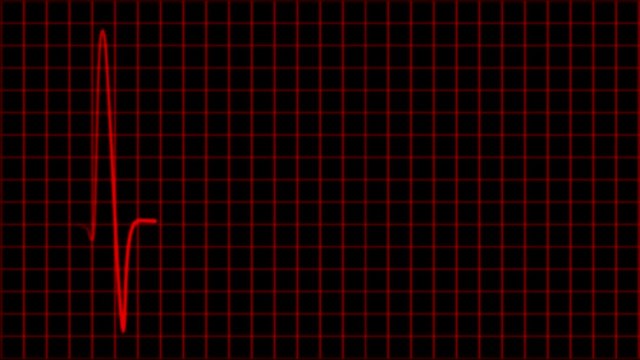 Cardiogram cardiograph oscilloscope screen loop 4k
