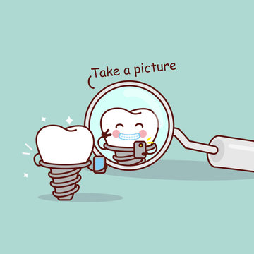 cartoon implant tooth take picture