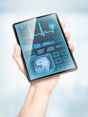 Showing medical data