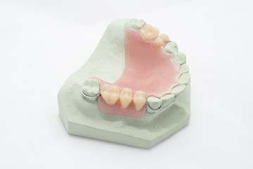 Dental cast during processing denture