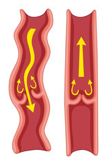 Obraz na płótnie Canvas Varicose veins in human body