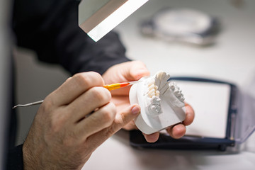 Hands of a prosthetic dentist, detailing on teeth mould
