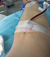 blood transfusion at the hospital