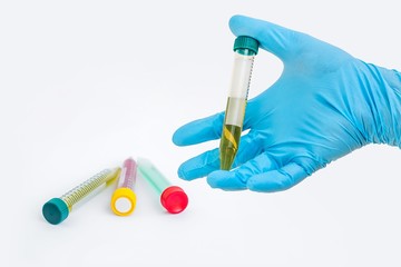 Scientists hand holding a test-tube with green liquid