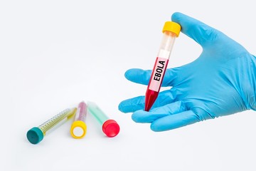 Naklejka premium Test-tube with blood sample for EBOLA test