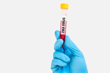 Test-tube with blood sample for ZIKA virus test