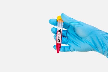 Test-tube with blood sample for SYPHILIS test