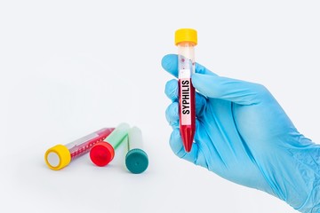 Test-tube with blood sample for SYPHILIS test