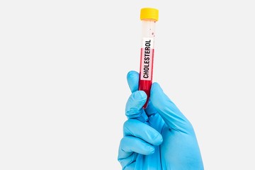 Test-tube with blood sample for CHOLESTEROL test