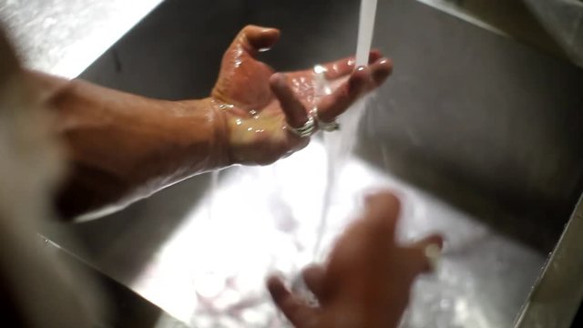 man washes the blood off the hands under the tap water