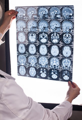 Hands of a doctor holding mri