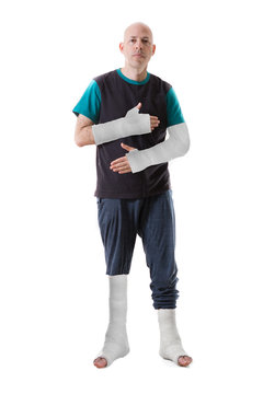 Young man with a broken ankle and a leg cast