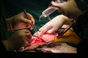 coronary artery bypass grafting