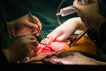 coronary artery bypass grafting