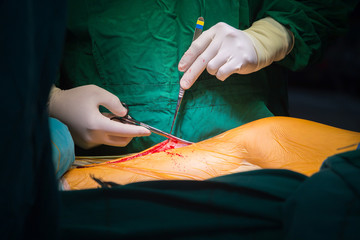 Surgery for Coronary Artery Bypass Grafting: CABG