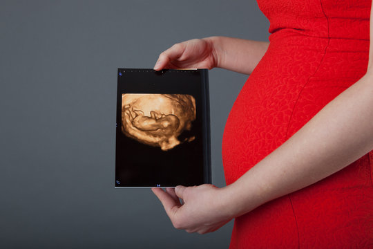 Pregnant woman showing ultrasound picture of the baby