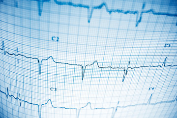 Naklejka premium Electrocardiogram