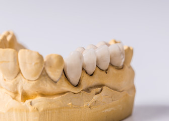 Fototapeta premium Dental prosthesis