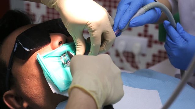 There is the close up image of dentist changing dental crowns for saving decayed teeth in male client mouth.