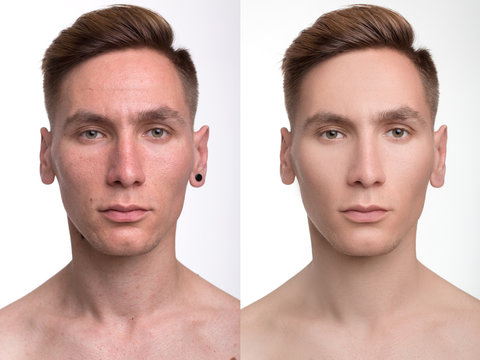 man before and after retouch