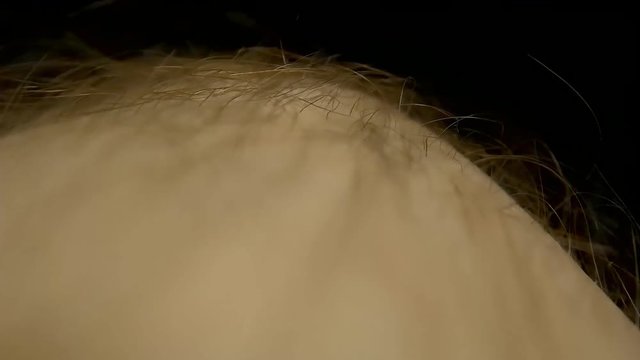 Insect crawling through the hair on the human leg. Macro
