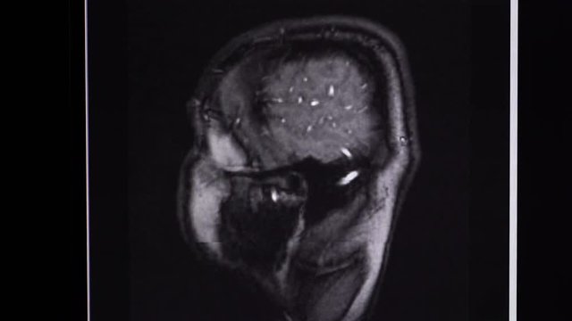 MRI brain scan, side view, top view