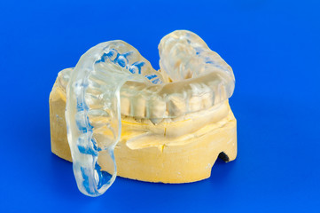 dental bite with chalk model