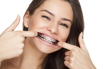 Face of a young woman with braces on her teeth