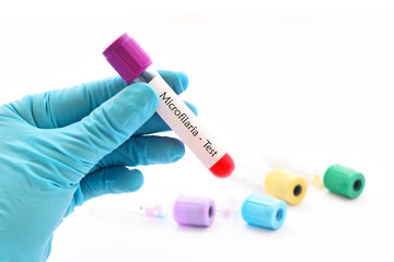 Blood sample for Microfilaria parasite (roundworms) test
