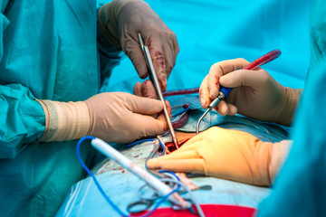 orthopedic surgeons hands while operating the human spine.