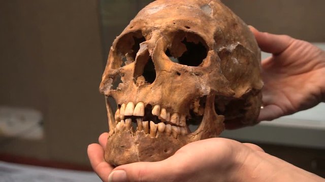Anthropology. Skull Men Nomadic Sarmatian Age of 3000 Years in the Hands of the Scientist in the Museum