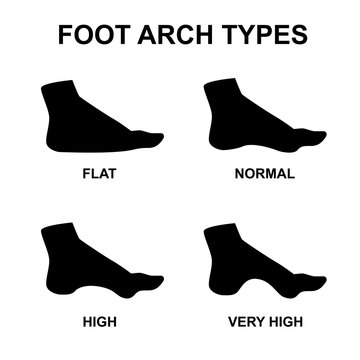 Set Of Flat Foot, High Arch