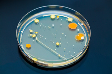 Petri dish