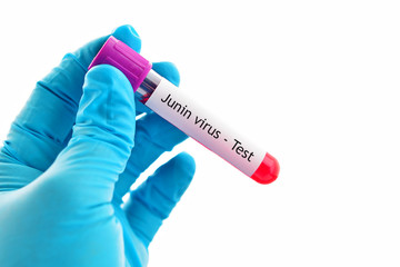 Obraz premium Blood sample for Junin virus test, diagnosis for South American hemorrhagic fevers 