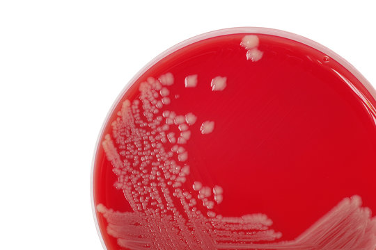 Salmonella enteritidis bacterial colonies on blood agar plate, m