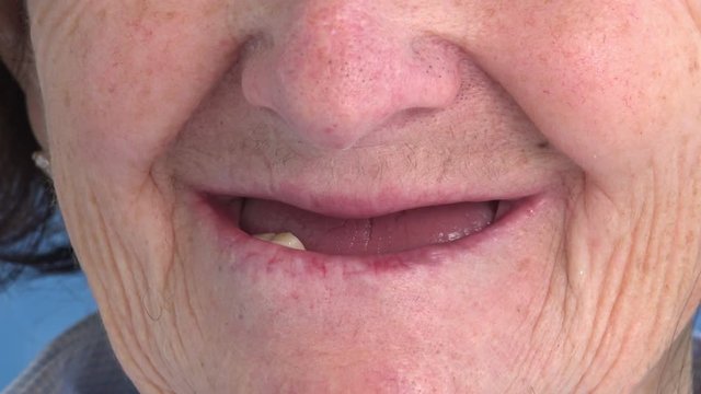 toothless old woman speaks: Woman with dental problems
