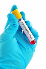 Naklejka premium Blood sample for allergy profile test 