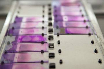 Microscopic slides with blood samples