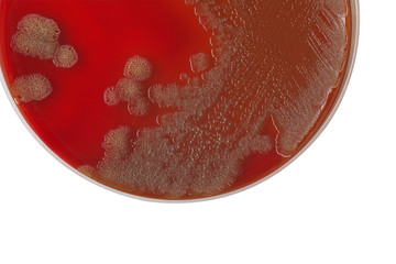 Vibrio cholerae bacterial colonies on blood agar plate, medical